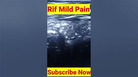 Rif pain in lower abdomen l appendicitis in rif pain #youtubeshorts # ...