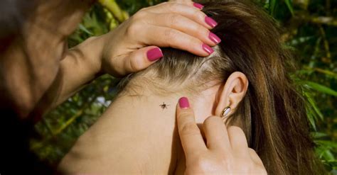 What Are Seed Ticks And How To Deal With Them - Wiki Point