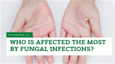 Who is Affected the Most by Fungal Infections?