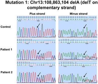 Dubowitz Syndrome Is a Complex Comprised of Multiple, Genetically ...