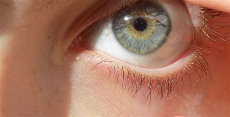 central heterochromia , the center of the eye is yellow/brown and the ...