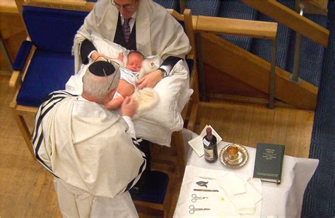 Circumcision: a little off the top