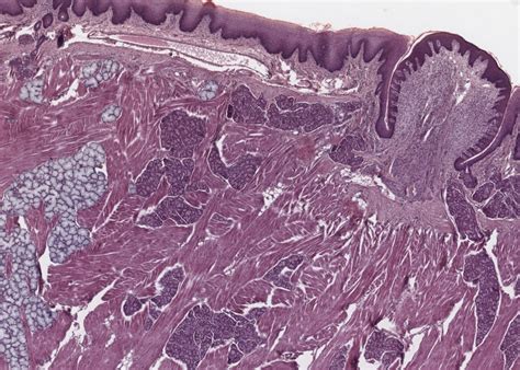 Oral Cavity, Tooth and Gingiva – Meyers Histology