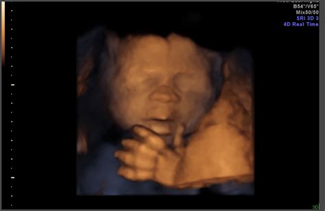 [最新] 24 weeks pregnant ultrasound 3d 214767-Can you get a 3d ultrasound ...