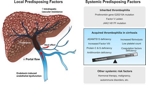 Nontumoral Portal Vein Thrombosis: A Challenging Consequence of Liver ...