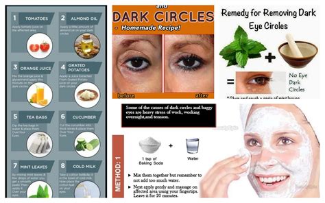 Natural Remedies That Will Help You Remove The Dark Circles Under Your ...