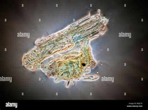 Difflugia hi-res stock photography and images - Alamy