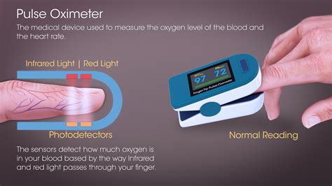 Pulse Oximetry: Mechanism, History, Use and Sources of error