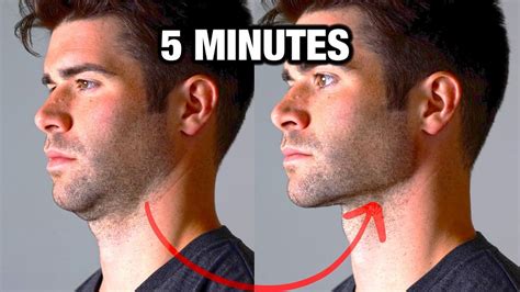 How to Get A More Defined Jawline - In Only 5 Minutes! - YouTube ...