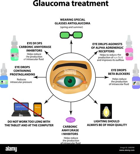 Glaucoma treatment. Eye drops. World glaucoma day. The anatomical ...