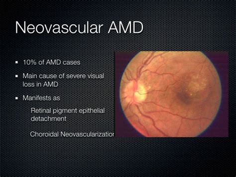 Amd lecture pao 2009