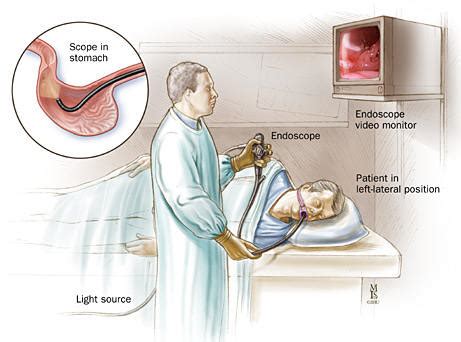 EGD Procedure | Freedom From Obesity