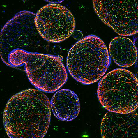 3D Cell Culture In Vitro Modeling Explores New Depths