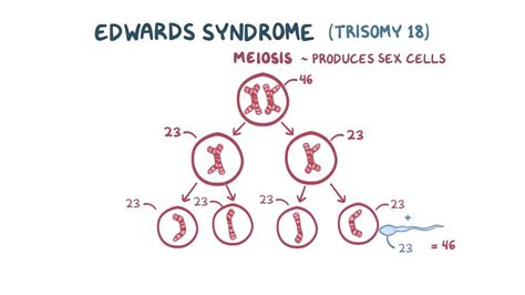 Down Syndrome Meiosis