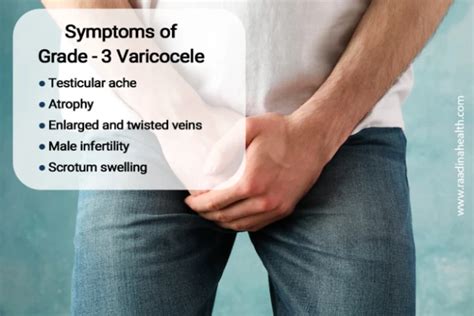 Varicocele Grade 4