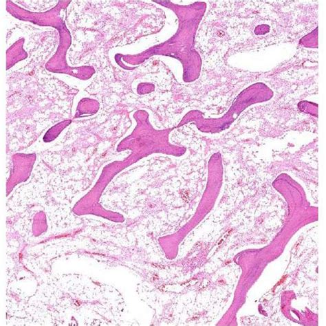 Cancellous Bone Histology