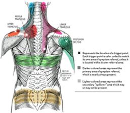 Your Referrals Can Be A ‘Real’ Pain | Boston Bodyworker