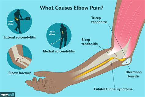 Elbow Pain: Causes and When It's Serious