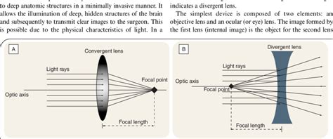 (A) Example of a convergent biconvex lens. (B) Example of a divergent ...