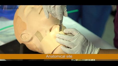 Emergency Cricothyroidotomy Procedure | Pricothyroidotomy Procedure ...