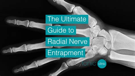 The Ultimate Guide to Radial Nerve Entrapment, causes and prevention?