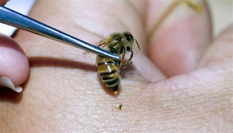 Do Bumble Bees Sting? Find Out! | Balcony Garden Web