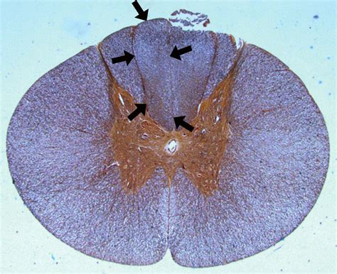 Medulla Spinalis Histology