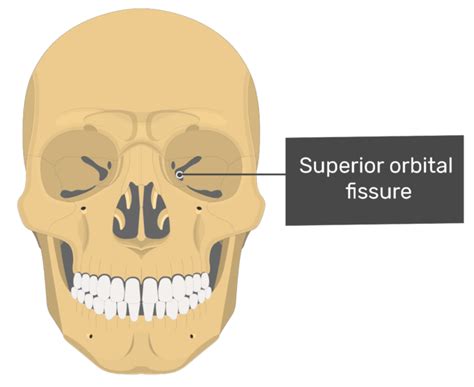 Superior Orbital Fissure Sphenoid