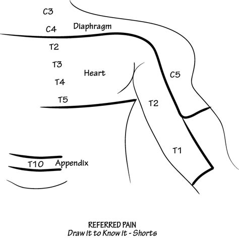 Referred Pain | ditki medical and biological sciences