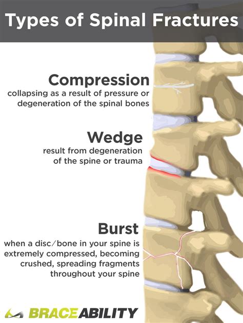 What Does it Mean If I’ve Been Diagnosed with a T12 or L1 Vertebral ...