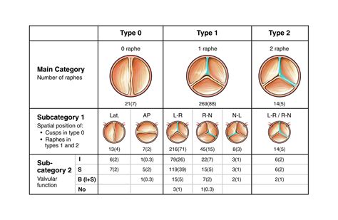 Aortic Valve Repair and Valve-Sparing Aortic Root Replacement | Adult ...