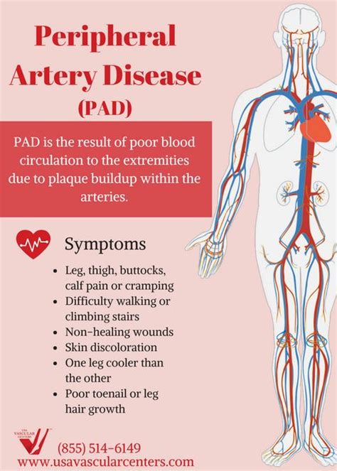 USA Vein Clinics | Trusted Vein Treatment Centers for Vein Disease ...