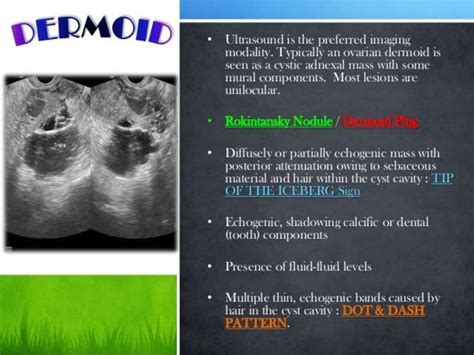 Basic gynae ultrasound