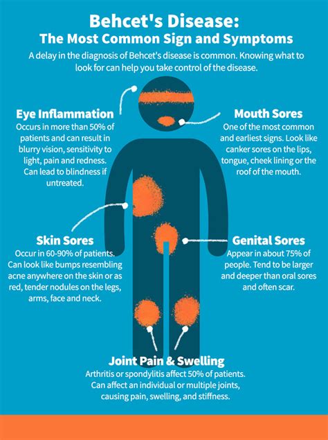 Behcet's Disease Rash Pictures - magdalena-encore