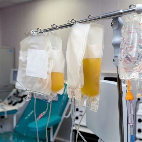 Apheresis: what you need to know