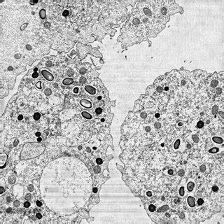 Electron microscopy imaging of the Pithovirus replication cycle in A ...