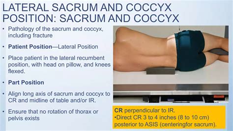 Radiographic views of sacrum and coccyx | PPT | Free Download