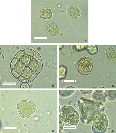 Photographs of pollen grains obtained from optical microscope of the ...