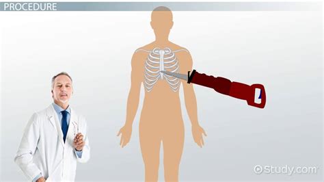 Autopsy Incision Diagram