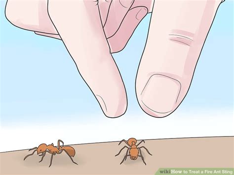 How to Treat a Fire Ant Sting: 14 Steps (with Pictures) - wikiHow