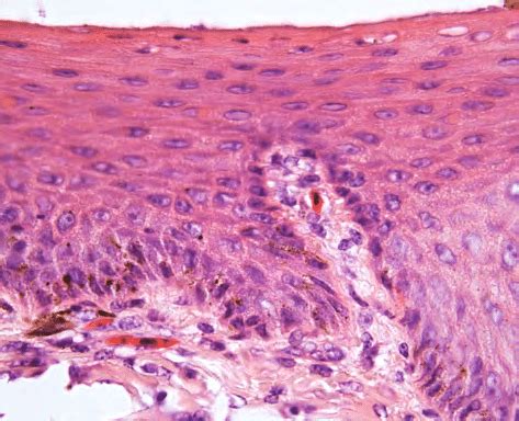 Stratified Squamous Keratinized Epithelium Labeled