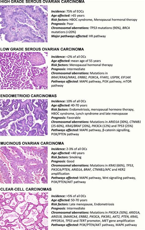 Ovarian Cancer Tumor Types