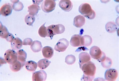 Plasmodium Microscope Slide