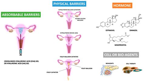 IJMS | Free Full-Text | Focus on the Primary Prevention of Intrauterine ...