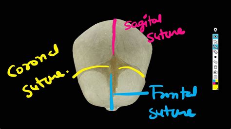 Fetal Skull Sutures and fontanelles - Short Lacture - YouTube