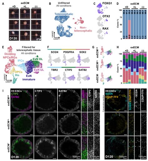 Mature organoid culture produces comparable cell types across ...