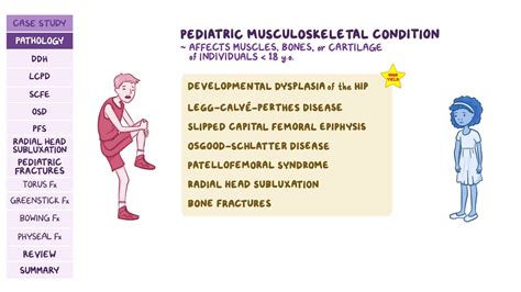 Pediatric musculoskeletal disorders: Pathology review | Osmosis