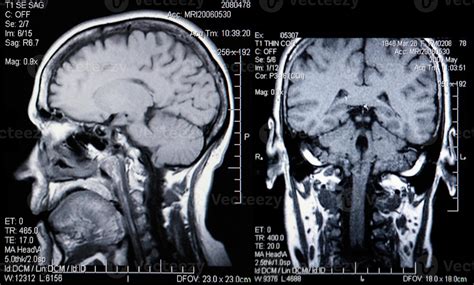 Real MRI Scans of the Head and Brain 3636996 Stock Photo at Vecteezy