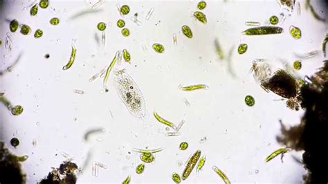 Wimpertierchen - Ciliophora - Hypotrichida - Ciliata - microorganisms ...