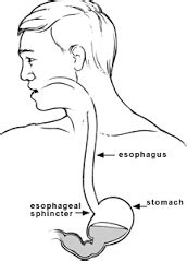 Fundoplicatura de Nissen: O que é, detalhes do procedimento e ...